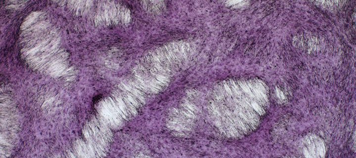 slider_7